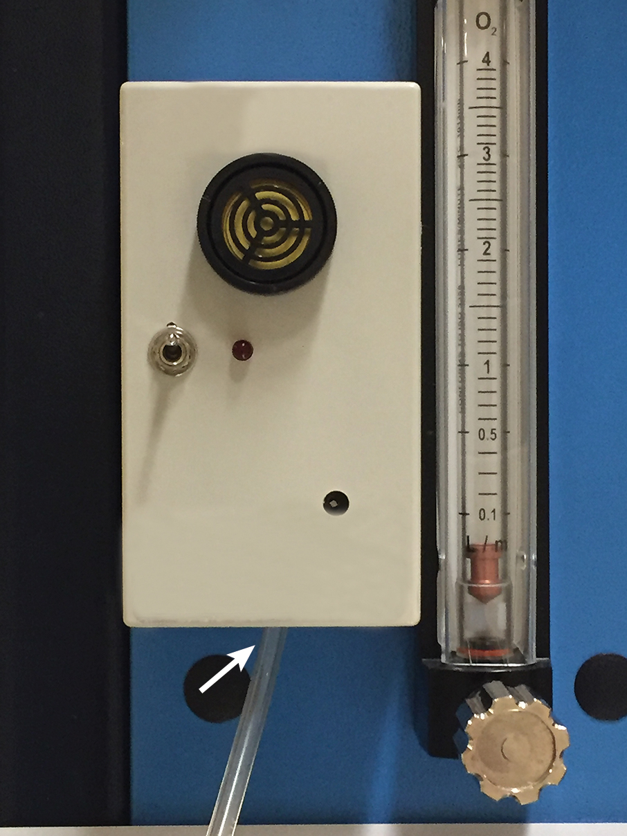 Barotrauma ventilator qustcentral